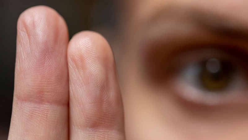 EMDR close-up